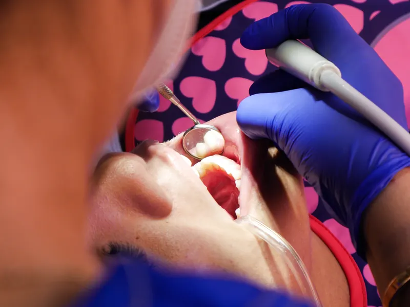 Primer plano de un procedimiento dental realizado en Novaodent