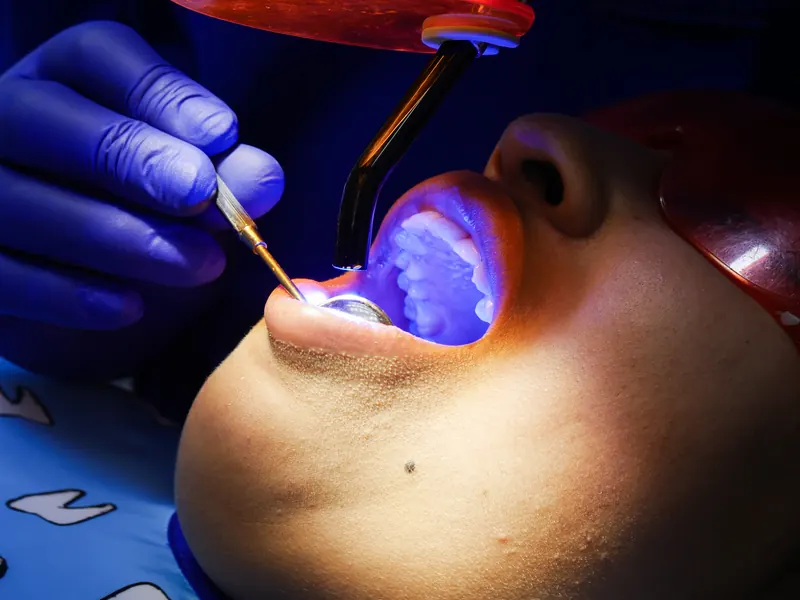 Tecnología de iluminación aplicada durante un tratamiento odontológico