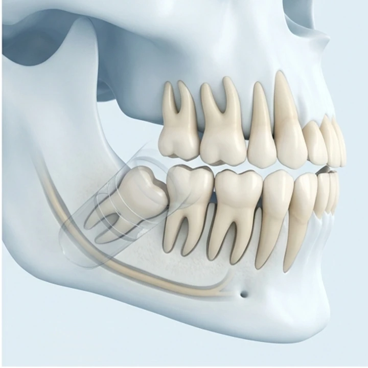 Visualización referencial de la planificación de una cirugía dental